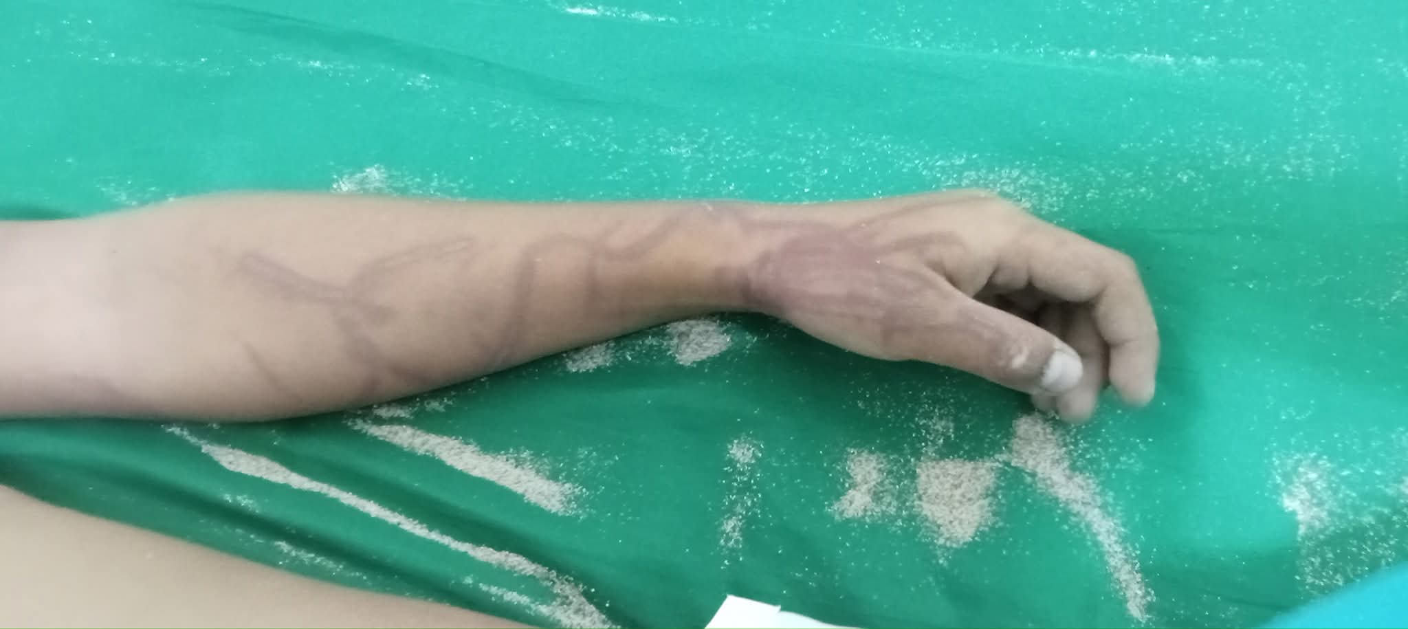 5 anyos na babae, patay sa dikya sa Buenavista, Quezon