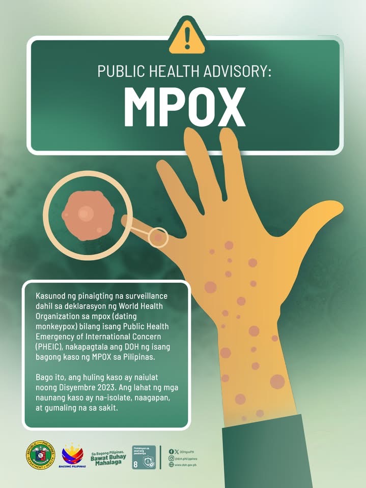 2 aktibong kaso ng Mpox, naitala sa Laguna